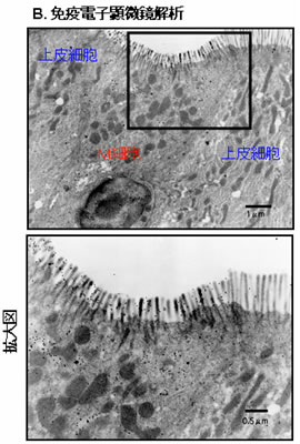 図2. M細胞特異的抗体（NKM 16-2-4）を用いた免疫組織学的解析（B.免疫電子顕微鏡解析）