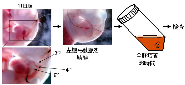 図4：左側第6鰓弓動脈を結紮（消失するはずの右側第6鰓弓動脈が残る）
