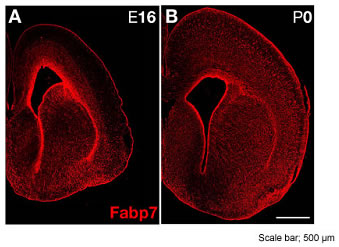 図6　胎生期と新生児期のFabp7タンパク質の発現