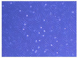 図１　ヒトiPS細胞　線維芽細胞