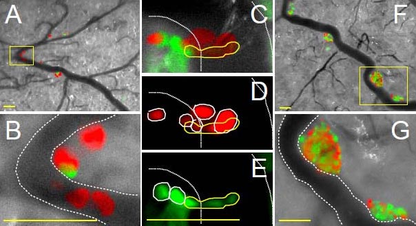 図5 Fucci発現細胞のヌードマウス浸潤・転移実験