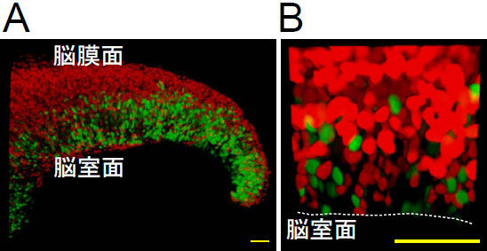 図7 Fucci-トランスジェニックマウスの脳原基におけるタイムラプスイメージング