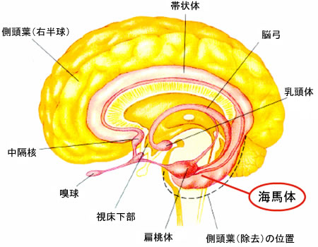 図1