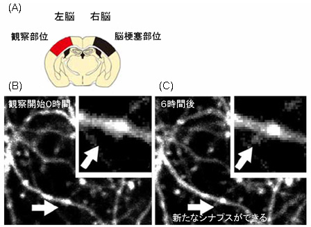 脳梗塞でも反対側の脳が失われた機能を 肩代わり 神経回路のつなぎ換えと機能回復を順々に促進