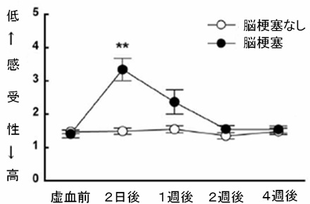 脳梗塞でも反対側の脳が失われた機能を 肩代わり 神経回路のつなぎ換えと機能回復を順々に促進