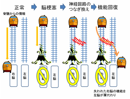 脳梗塞でも反対側の脳が失われた機能を 肩代わり 神経回路のつなぎ換えと機能回復を順々に促進