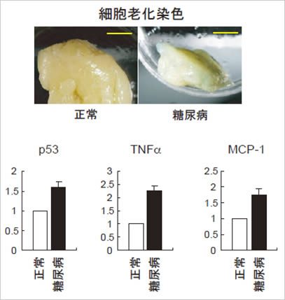 図６　糖尿病患者の内蔵脂肪