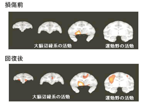 写真は、左から右へ、鼻側（前側）から後頭部側（後側）の脳の断層像