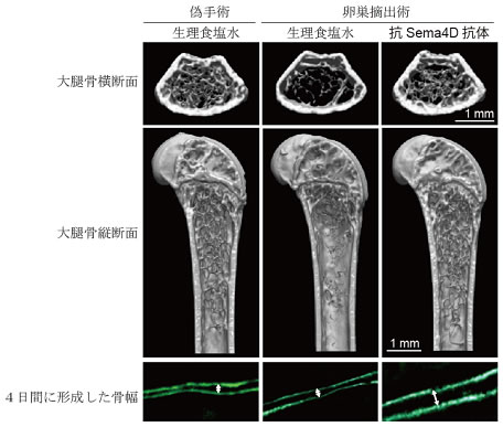 マウスの骨再生に成功 新たな骨形成促進剤の開拓へ道 骨粗しょう症や関節リウマチ がんによる骨破壊などの新たな治療へ