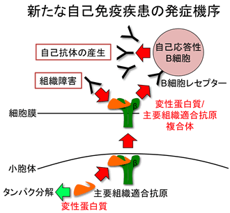 自己 免疫 疾患 と は