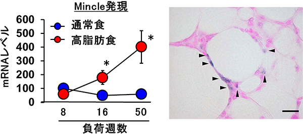 肥満に伴う脂肪組織の線維化を招く鍵分子を発見～メタボリックシンドローム治療の新たな分子標的～