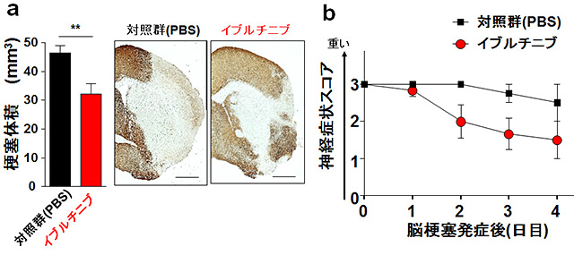 梗塞 治療 脳 脳梗塞を発症したときに知っておきたい治療法一覧