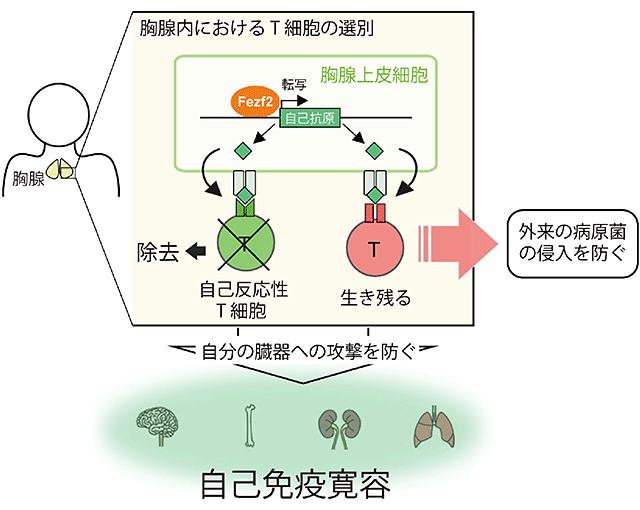 自己 免疫 疾患 と は