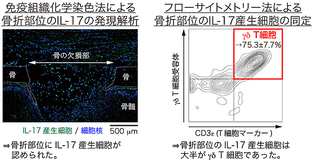 ΓδT細胞