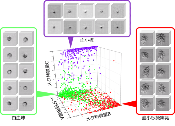図２　機械学習による血小板、血小板凝集塊および白血球の分類