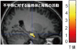 図２　経済的不平等に対する扁桃体と海馬の活動パターン