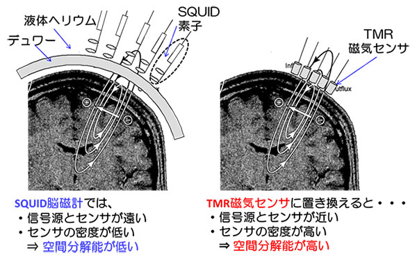 図１－２　従来のＳＱＵＩＤ脳磁計とＴＭＲ磁気センサによる脳磁計の比較