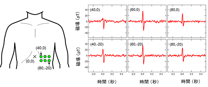 図３－３　ＴＭＲ磁気センサで測定した心磁図の測定位置依存性