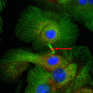 図２　正常マウスの肝細胞の初代培養における活性化Ｅｒｋ（ｐＥｒｋ１／２）の発現