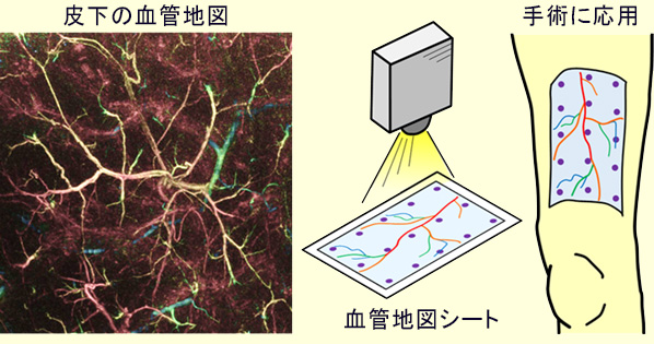 光超音波トモグラフィで皮膚の精細な3D血管地図の作成に成功