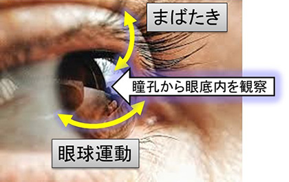 図１　目の動きと眼底観察