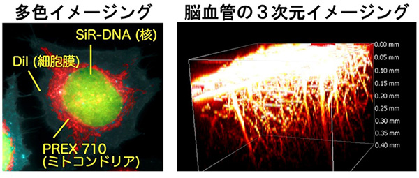 図３　ＰＲＥＸ ７１０を用いた蛍光イメージングの例