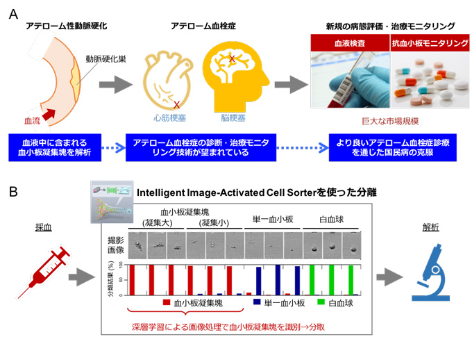 å³ï¼ãè¡æ¶²ç´°èãç¨ããæ¬æè¡ã®å»å­¦ã¸ã®å±é