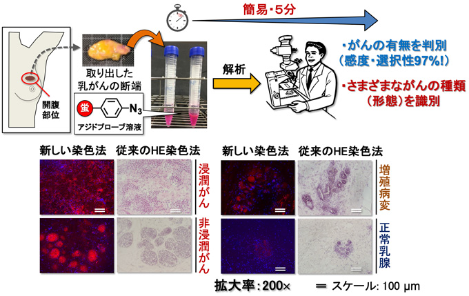 図　手術中に切除する乳がん部位を迅速に見極める新しい診断技術