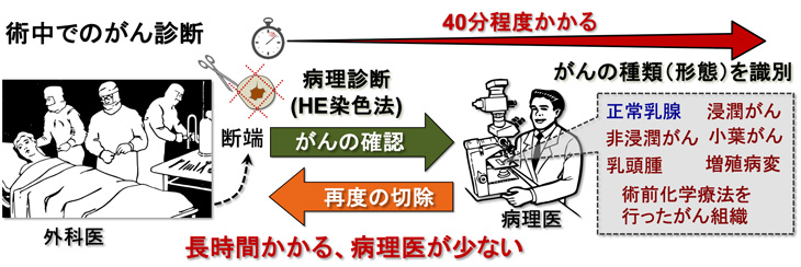 図１　乳がんの術中診断に用いられている病理学的診断（ＨＥ染色法）