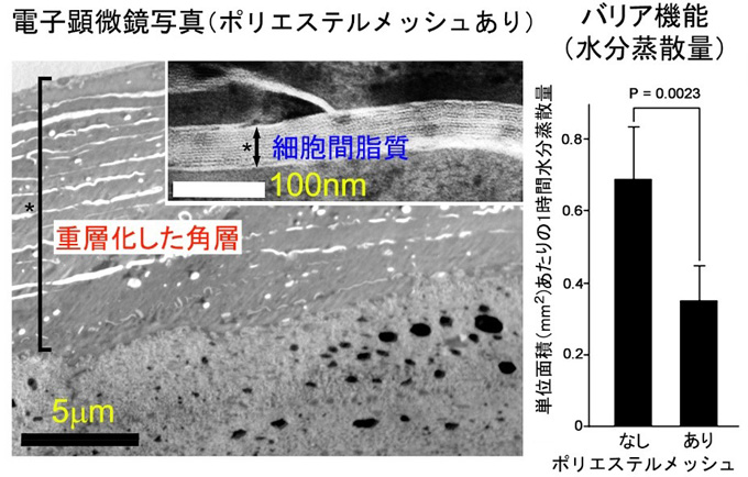 図３　電子顕微鏡とＴＥＷＬ法を用いたバリア機能評価