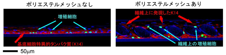 図４　基底層細胞、増殖細胞マーカーを用いた免疫染色による各細胞の分布