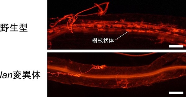 図２　野生型植物とｌａｎ変異体の菌根共生の様子