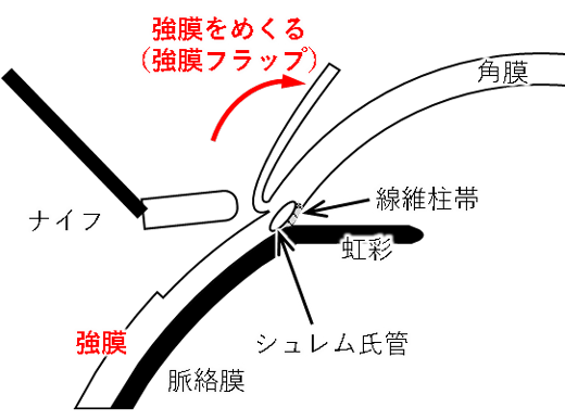 図２　強膜の薄切りの模式図