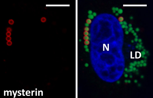 図１　ミステリンは細胞内に直径１μｍの球状構造を形成する