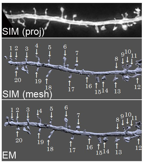 図１　ＳＩＭ（ｐｒｏｊ）超解像顕微鏡の生画像