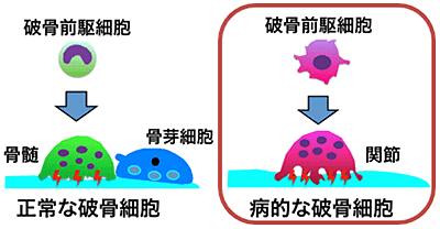 図１　悪玉破骨細胞の同定