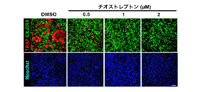 図４　ＦｏｘＭ１阻害薬がＡｔｏＭの破骨細胞分化を阻害する