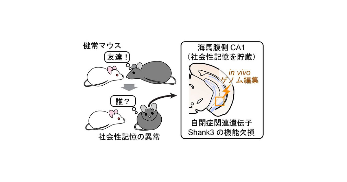 Amazon.co.jp: Kilah 自閉的依存症候群 V系 ビジュアル系