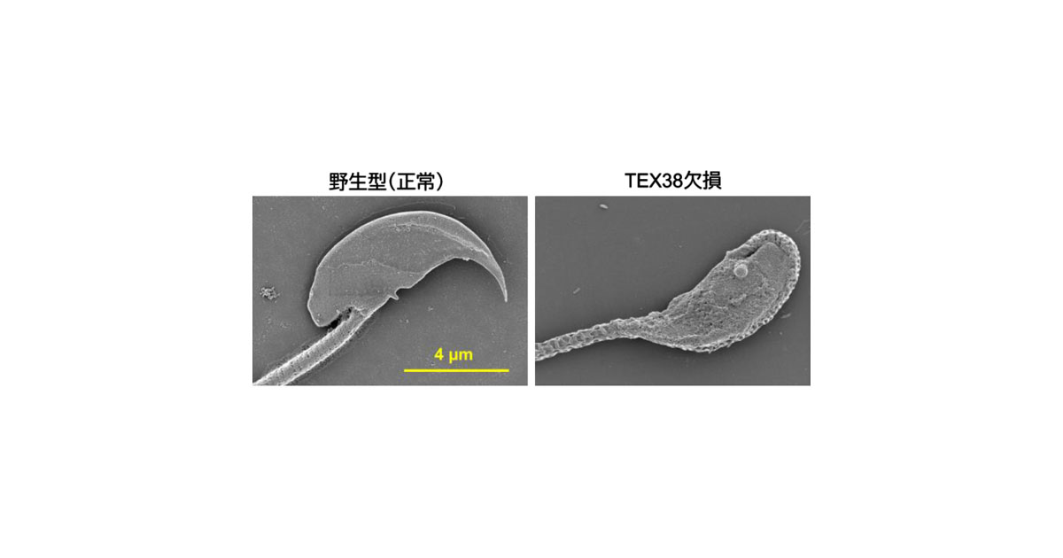 共同発表：精子の形成に必要なたんぱく質複合体を発見～細胞質を