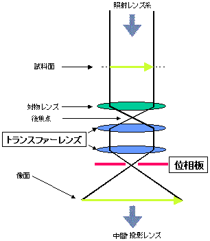 図２　右