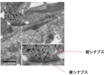 図3.免疫電子顕微鏡法を用いたSADキナーゼのシナプスにおける存在位置