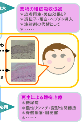 開発した技術概要