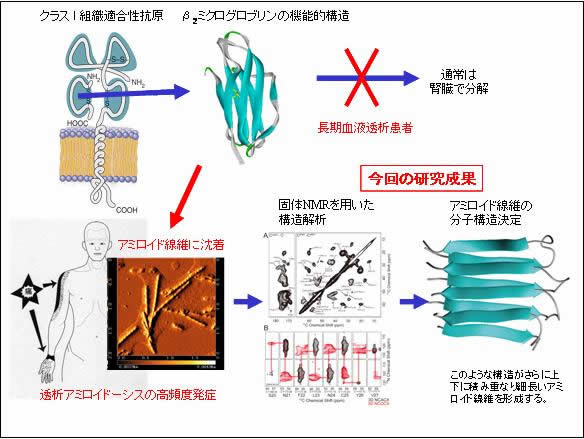 図１　透析アミロイド病とアミロイド線維の構造解析