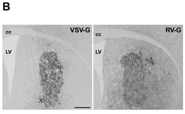 図４：HIV-1由来ベクターによるマウス脳内への遺伝子導入