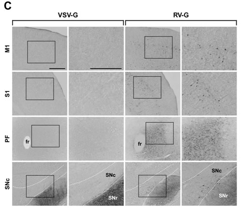 図４：HIV-1由来ベクターによるマウス脳内への遺伝子導入