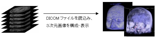 医療画像（DICOM3）データ、汎用画像フォーマットデータから３次元画像（ボリューム）を構成、表示