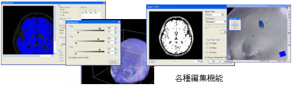 ３次元画像データや等値面データとしてそれぞれ各種フォーマットのファイル保存に対応