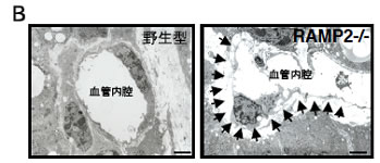 図１　RAMP2ノックアウトマウス(RAMP2-/-)胎仔の外観と血管構造の異常