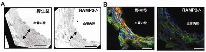 図２　RAMP2ノックアウトマウス(RAMP2-/-)胎仔の大動脈壁構造の異常
