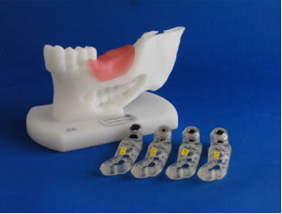 図３　顎骨模型と各種ドリルに対応したサージカルガイド